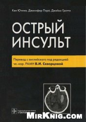 Острый инсульт