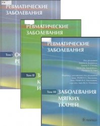 Ревматические заболевания: в 3-х томах. Т.1., Т.2, Т.3