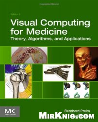 Visual Computing for Medicine, Second Edition: Theory, Algorithms, and Applications