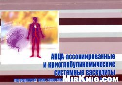 АНЦА-ассоциированные и криоглобулинемические системные васкулиты
