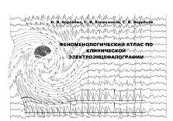 Феноменологический атлас по клинической электроэнцефалографии