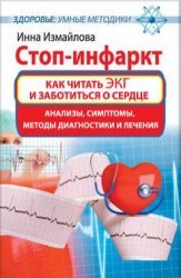 Стоп-инфаркт. Как читать ЭКГ и заботиться о сердце