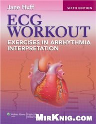 ECG workout: exercises in arrhythmia interpretation