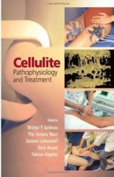 Cellulite: Pathophysiology and Treatment