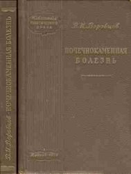 Почечнокаменная болезнь