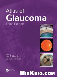 Atlas of Glaucoma (Third Edition)
