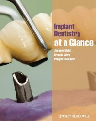 Implant Dentistry At-a-Glance