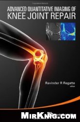 Advanced Quantitative Imaging of Knee Joint Repair