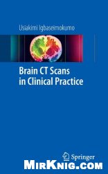 Brain CT Scans in Clinical Practice