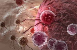 Рак легких может «затаиться» в организме на 20 лет