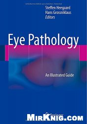 Eye Pathology: An Illustrated Guide